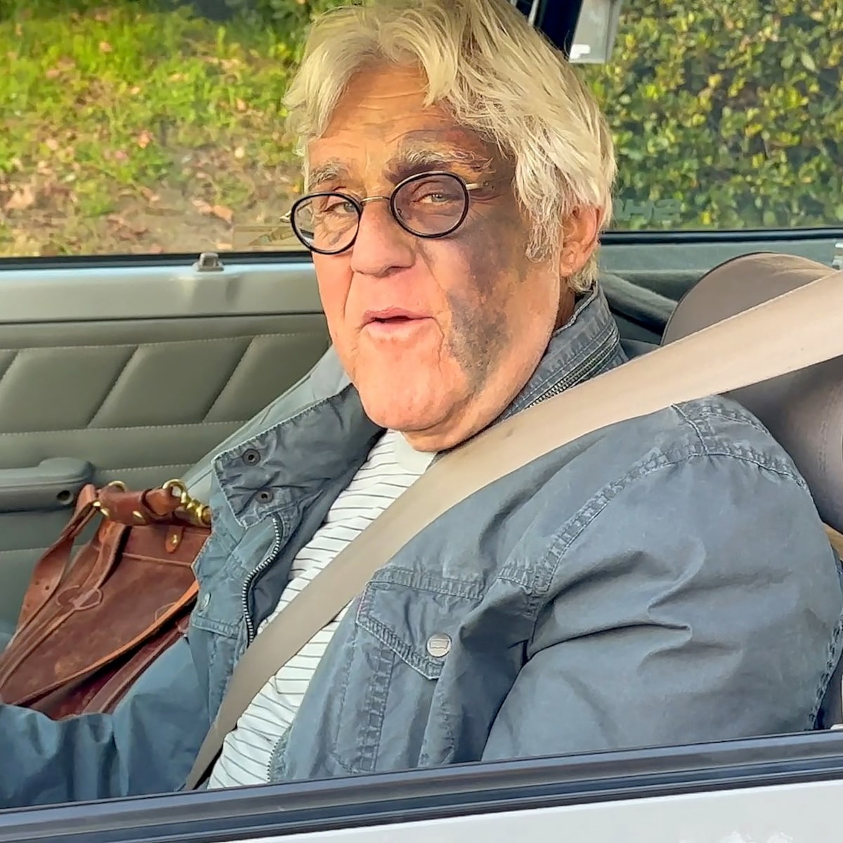 Jay Leno Shows His Badly Bruised Face After Nasty Fall Down 60-Foot Hill