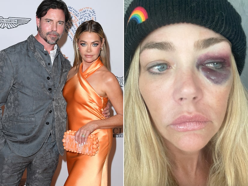 Denise Richards Accuses Aaron Phypers of Abuse, Granted Temporary Restraining Order