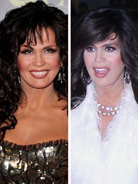 Marie Osmond At Hollywood Christmas Parade 2022 Marie Osmond's Camp On Plastic Surgery Rumors: 'Not Worth Commenting'